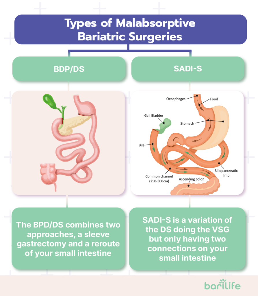 malabsorptive bariatric surgery