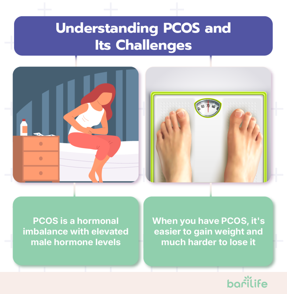 pcos and bariatric surgery