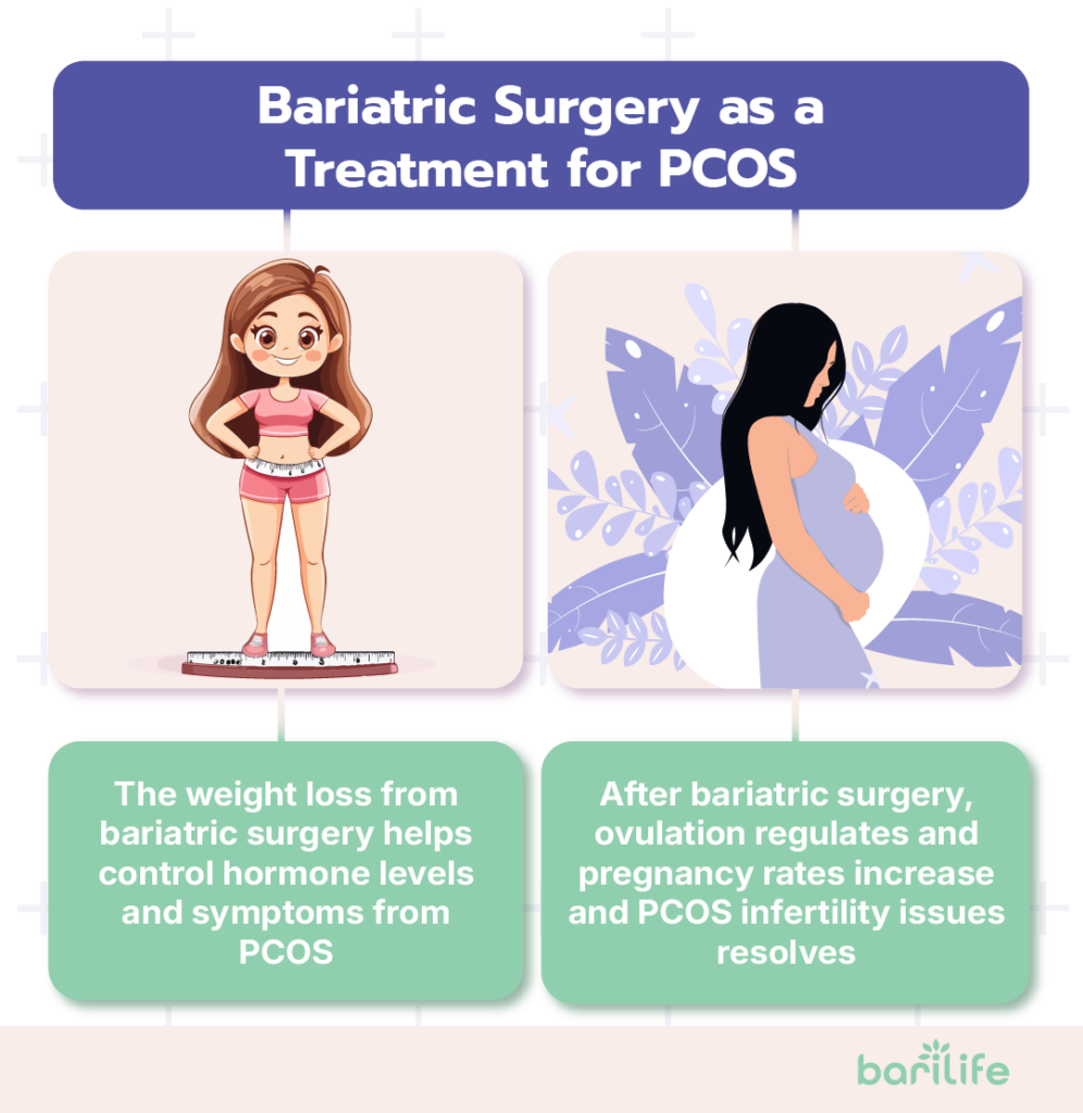 bariatric surgery pcos