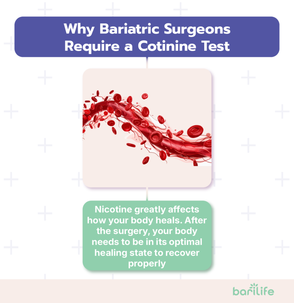 nicotine test for bariatric surgery