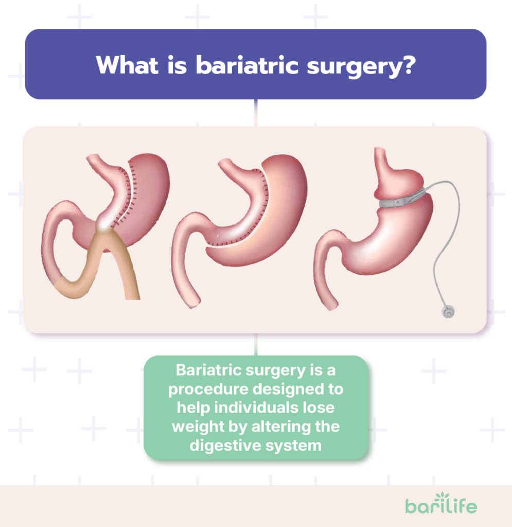 is bariatric surgery right for me