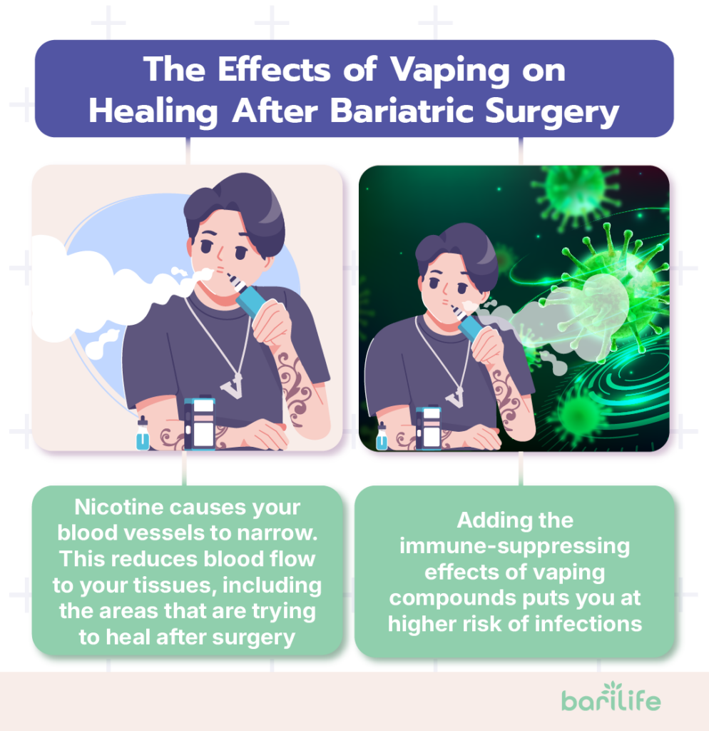vaping before bariatric surgery