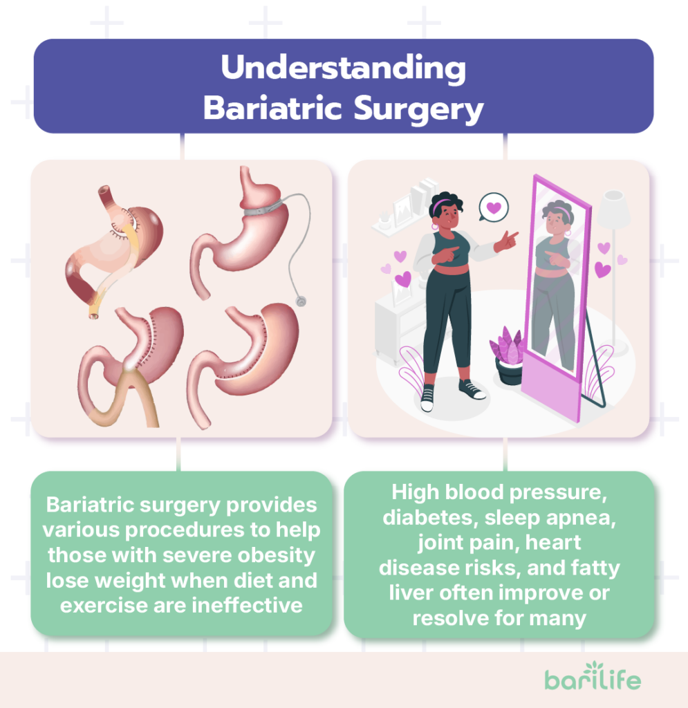 bariatric weight loss