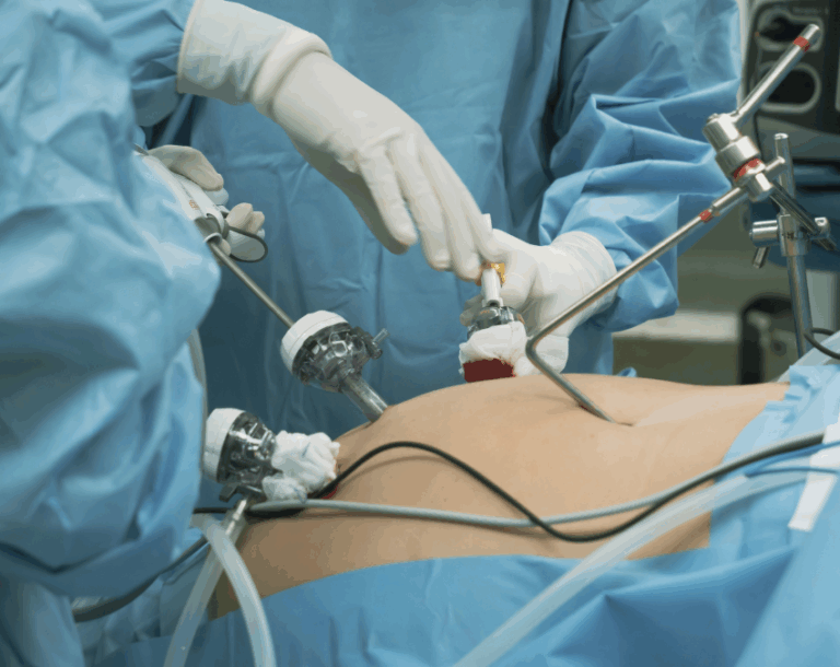 Bariatric Surgery Pros and Cons: Read Before You Decide