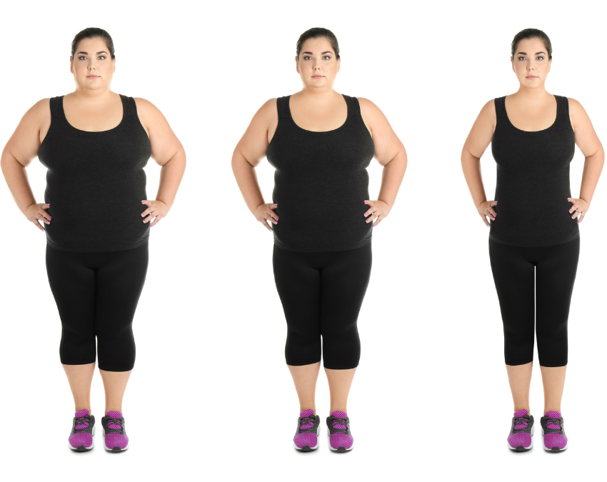 bariatric surgery before and after