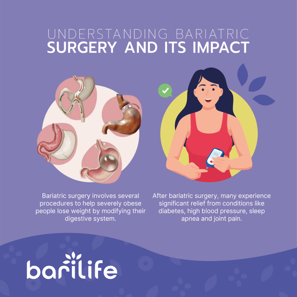bariatric surgery before and after