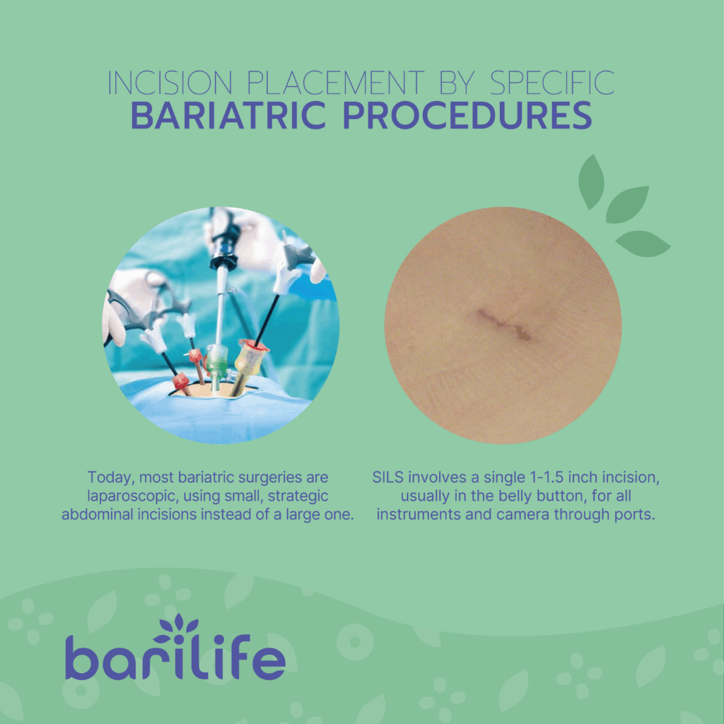 bariatric incisions