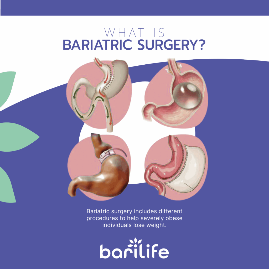 bariatric surgery scars