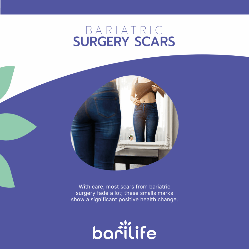 scars from bariatric surgery