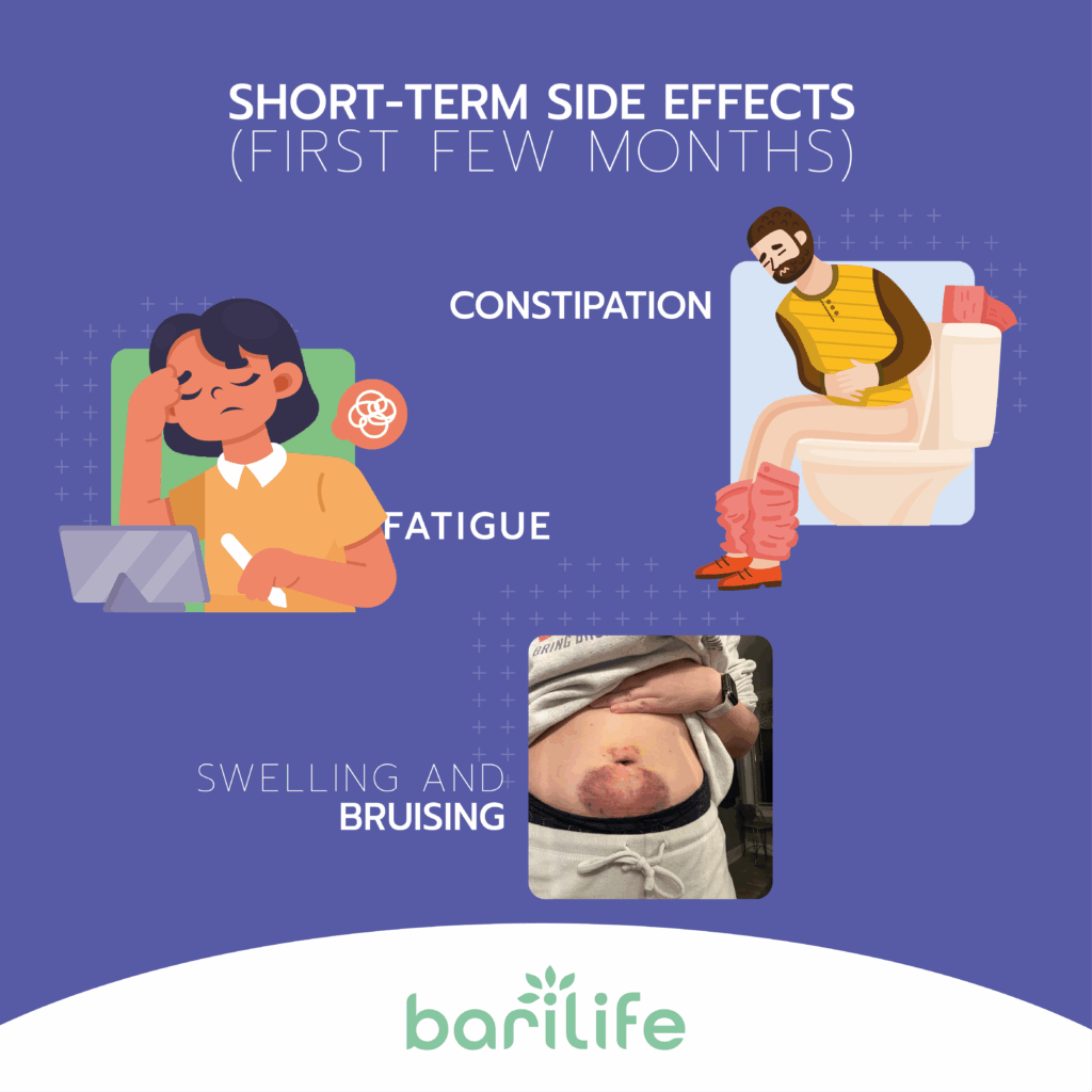 bariatric surgery disadvantages