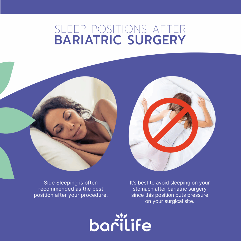 how to sleep after bariatric surgery