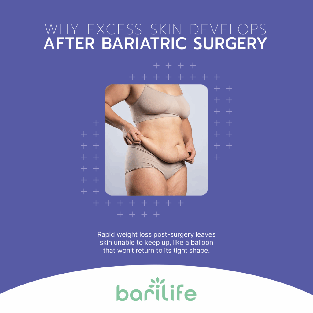 skin removal after bariatric surgery