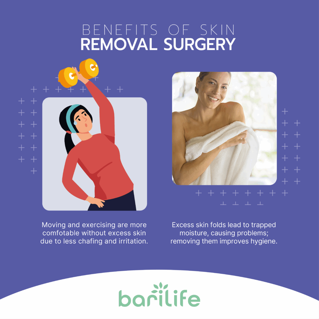 bariatric skin removal
