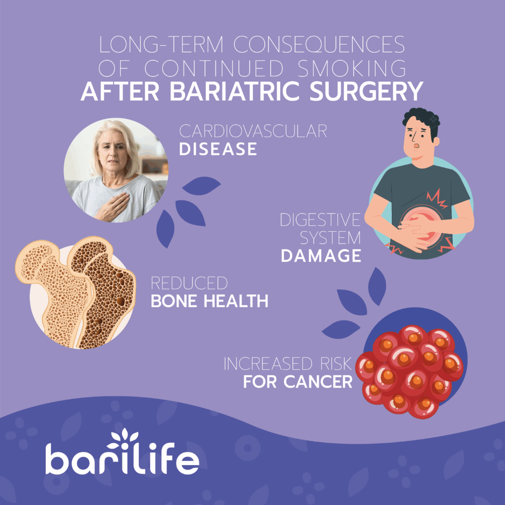smoking bariatric surgery